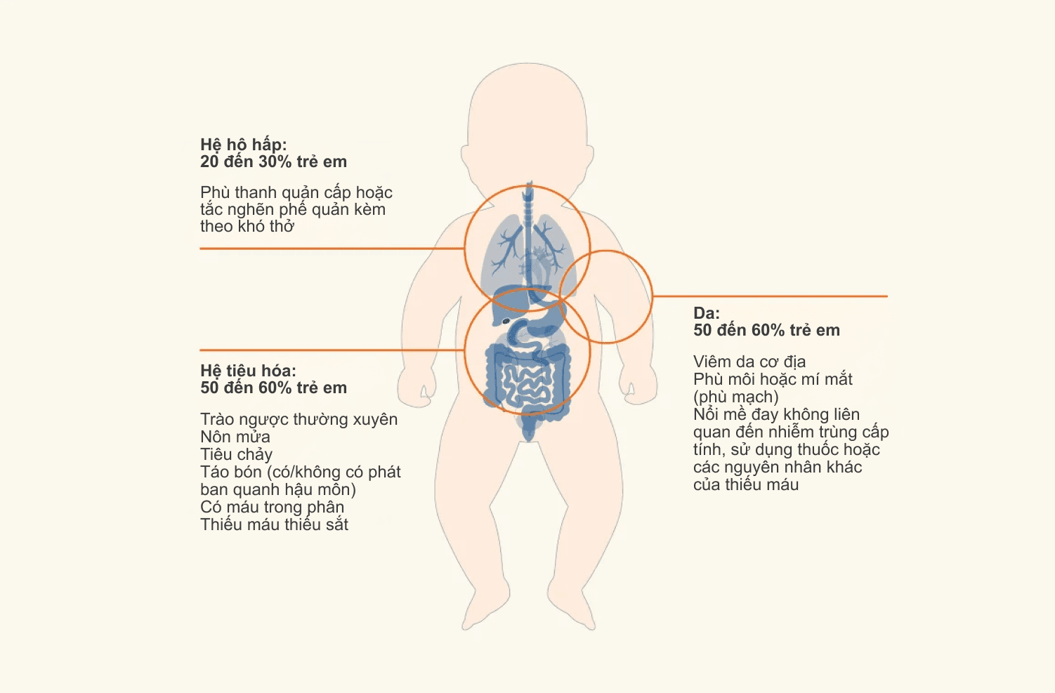 cmpa-symptoms